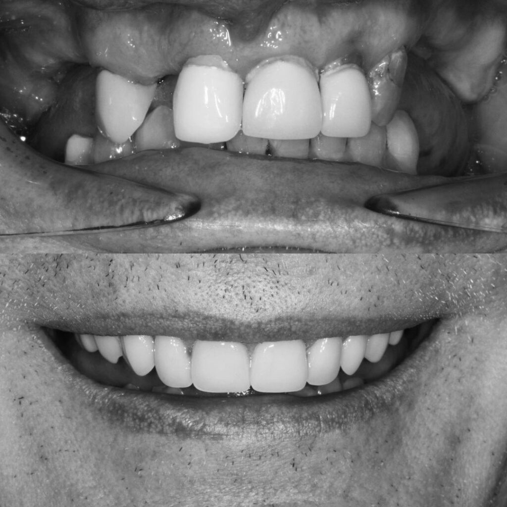imlpant dentist